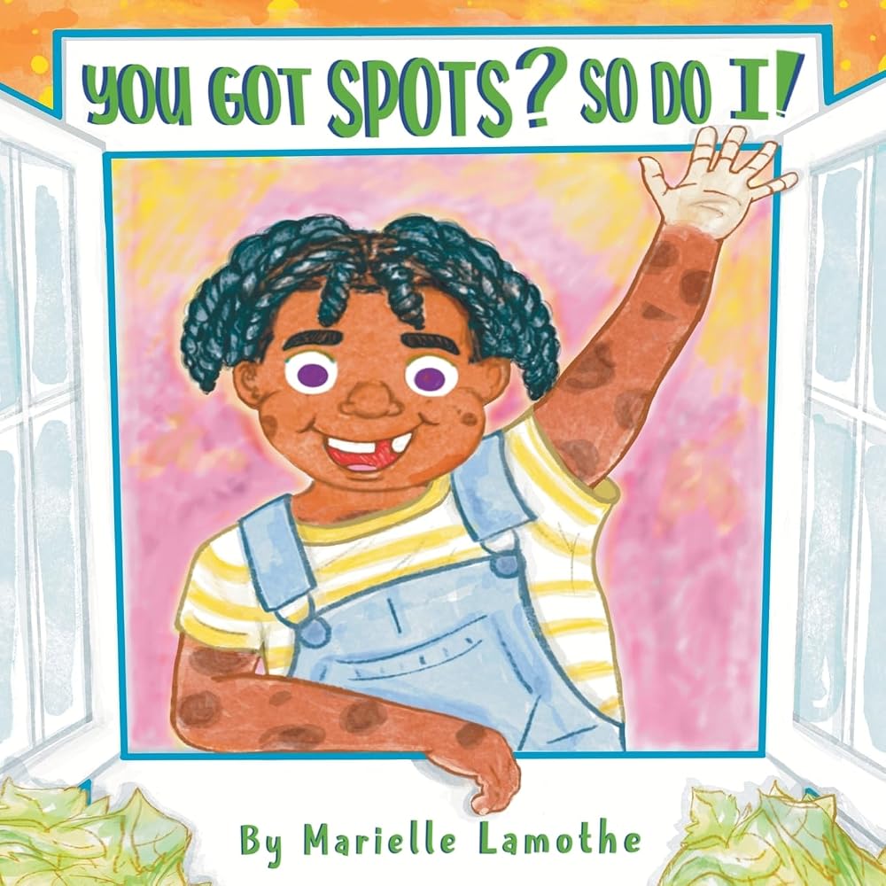 You Got Spots? So Do I! cover image